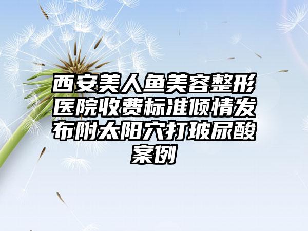 西安美人鱼美容整形医院收费标准倾情发布附太阳穴打玻尿酸案例