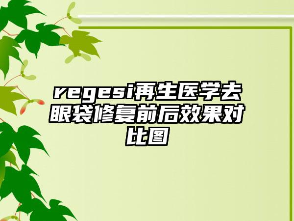 regesi再生医学去眼袋修复前后效果对比图