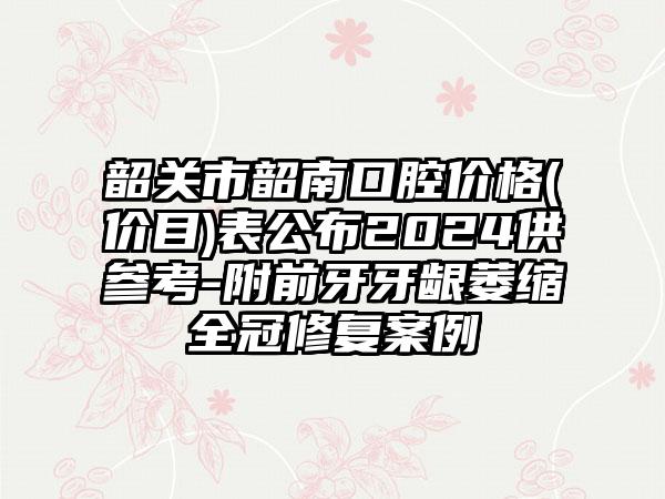 韶关市韶南口腔价格(价目)表公布2024供参考-附前牙牙龈萎缩全冠修复案例