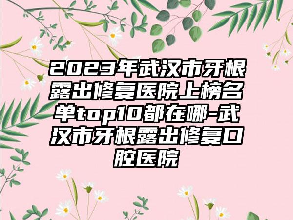 2023年武汉市牙根露出修复医院上榜名单top10都在哪-武汉市牙根露出修复口腔医院