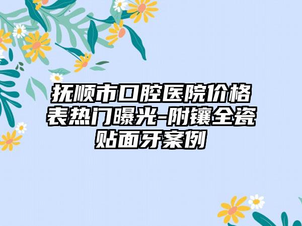 抚顺市口腔医院价格表热门曝光-附镶全瓷贴面牙案例