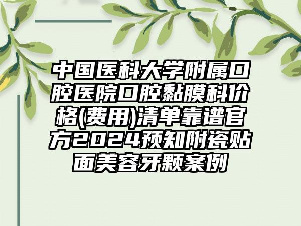 中国医科大学附属口腔医院口腔黏膜科价格(费用)清单靠谱官方2024预知附瓷贴面美容牙颗案例