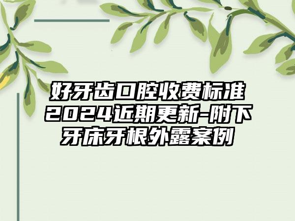 好牙齿口腔收费标准2024近期更新-附下牙床牙根外露案例