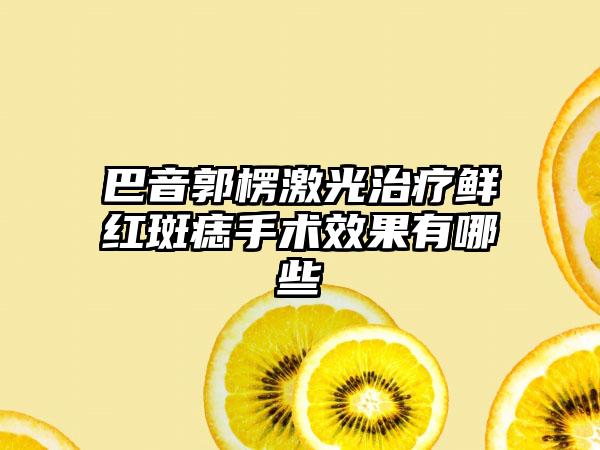 巴音郭楞激光治疗鲜红斑痣手术效果有哪些