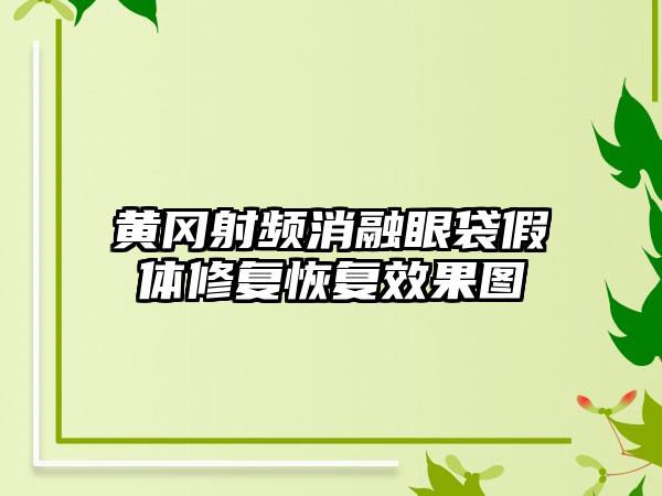 黄冈射频消融眼袋假体修复恢复效果图