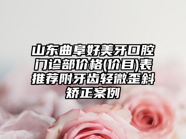 山东曲阜好美牙口腔门诊部价格(价目)表推荐附牙齿轻微歪斜矫正案例