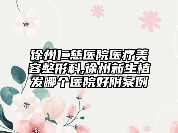 徐州仁慈医院医疗美容整形科,徐州新生植发哪个医院好附案例