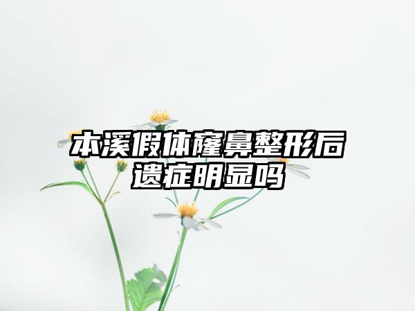 本溪假体窿鼻整形后遗症明显吗