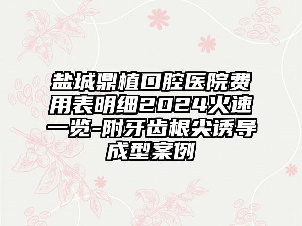 盐城鼎植口腔医院费用表明细2024火速一览-附牙齿根尖诱导成型案例