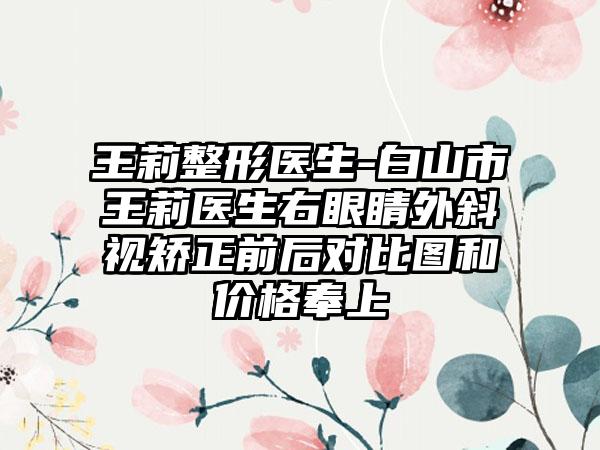 王莉整形医生-白山市王莉医生右眼睛外斜视矫正前后对比图和价格奉上