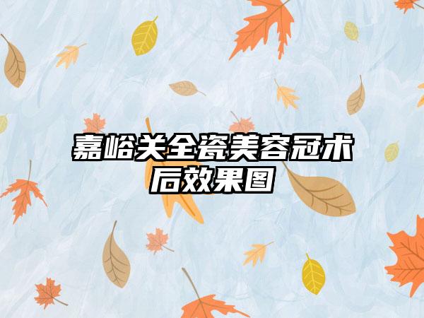 嘉峪关全瓷美容冠术后效果图