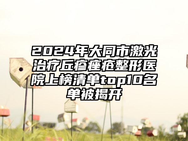 2024年大同市激光治疗丘疹痤疮整形医院上榜清单top10名单被揭开