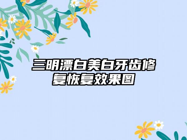 三明漂白美白牙齿修复恢复效果图