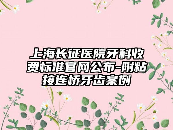 上海长征医院牙科收费标准官网公布-附粘接连桥牙齿案例