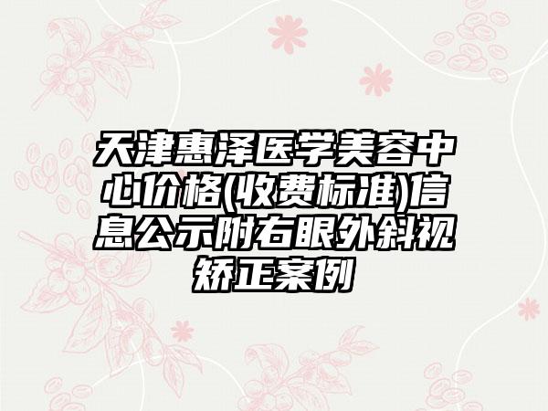 天津惠泽医学美容中心价格(收费标准)信息公示附右眼外斜视矫正案例