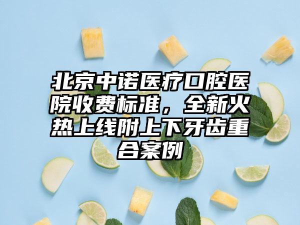 北京中诺医疗口腔医院收费标准，全新火热上线附上下牙齿重合案例