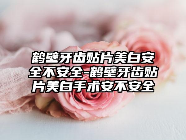 鹤壁牙齿贴片美白安全不安全-鹤壁牙齿贴片美白手术安不安全