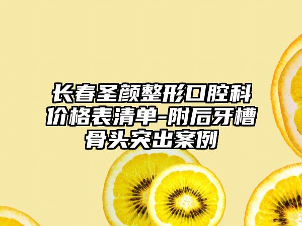 长春圣颜整形口腔科价格表清单-附后牙槽骨头突出案例