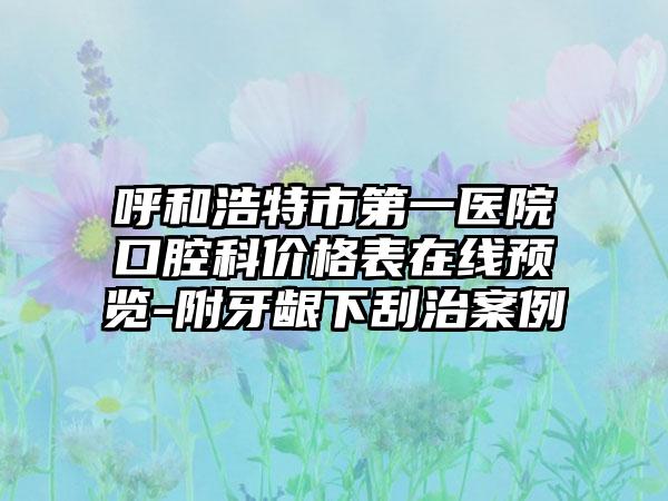 呼和浩特市第一医院口腔科价格表在线预览-附牙龈下刮治案例