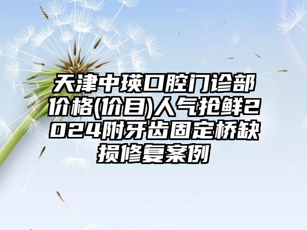 天津中瑛口腔门诊部价格(价目)人气抢鲜2024附牙齿固定桥缺损修复案例