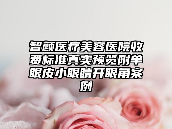 智颜医疗美容医院收费标准真实预览附单眼皮小眼睛开眼角案例