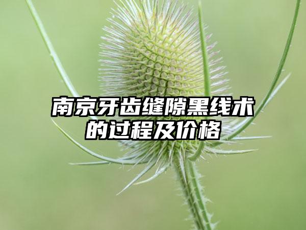 南京牙齿缝隙黑线术的过程及价格