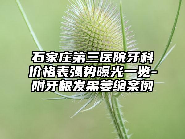 石家庄第三医院牙科价格表强势曝光一览-附牙龈发黑萎缩案例