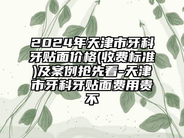 2024年天津市牙科牙贴面价格(收费标准)及案例抢先看-天津市牙科牙贴面费用贵不