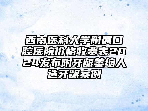 西南医科大学附属口腔医院价格收费表2024发布附牙龈萎缩人造牙龈案例