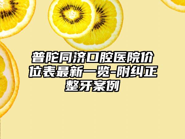 普陀同济口腔医院价位表最新一览-附纠正整牙案例