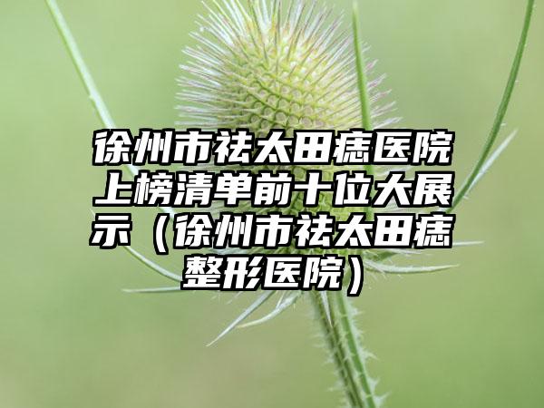 徐州市祛太田痣医院上榜清单前十位大展示（徐州市祛太田痣整形医院）