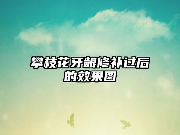 攀枝花牙龈修补过后的效果图