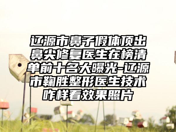 辽源市鼻子假体顶出鼻尖修复医生在榜清单前十名大曝光-辽源市鞠胜整形医生技术咋样看效果照片