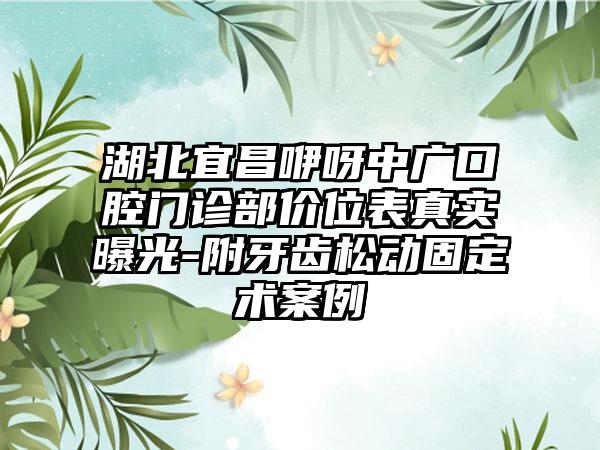 湖北宜昌咿呀中广口腔门诊部价位表真实曝光-附牙齿松动固定术案例