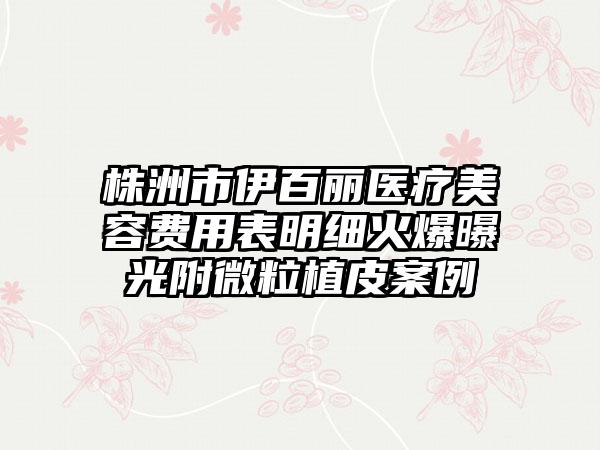 株洲市伊百丽医疗美容费用表明细火爆曝光附微粒植皮案例