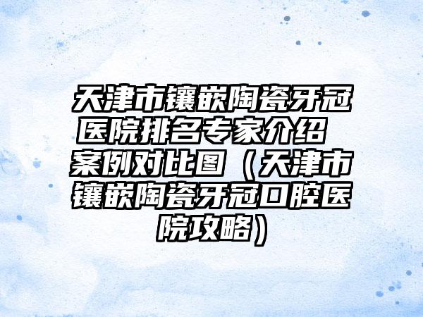 天津市镶嵌陶瓷牙冠医院排名专家介绍 案例对比图（天津市镶嵌陶瓷牙冠口腔医院攻略）