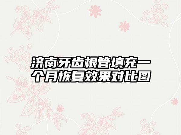 济南牙齿根管填充一个月恢复效果对比图