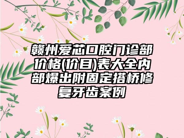 赣州爱芯口腔门诊部价格(价目)表大全内部爆出附固定搭桥修复牙齿案例