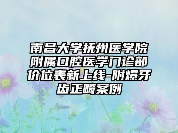 南昌大学抚州医学院附属口腔医学门诊部价位表新上线-附爆牙齿正畸案例