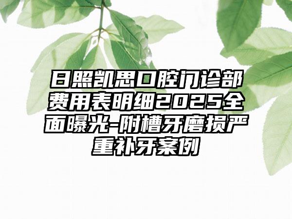 日照凯思口腔门诊部费用表明细2025全面曝光-附槽牙磨损严重补牙案例