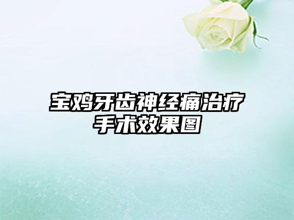 宝鸡牙齿神经痛治疗手术效果图