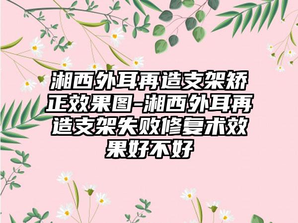 湘西外耳再造支架矫正效果图-湘西外耳再造支架失败修复术效果好不好