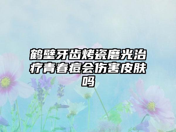 鹤壁牙齿烤瓷磨光治疗青春痘会伤害皮肤吗