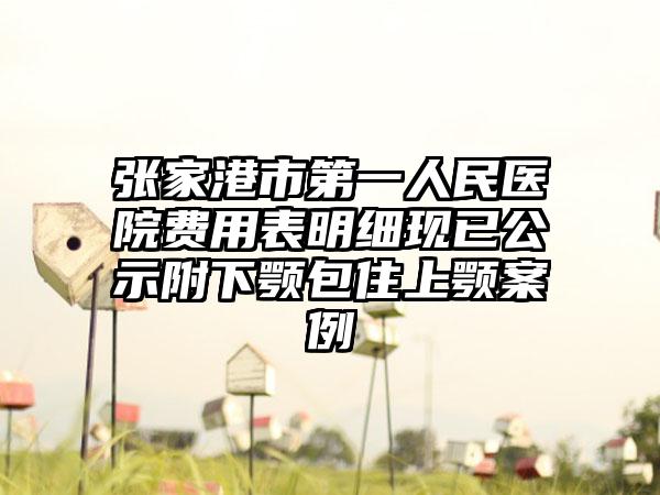 张家港市第一人民医院费用表明细现已公示附下颚包住上颚案例