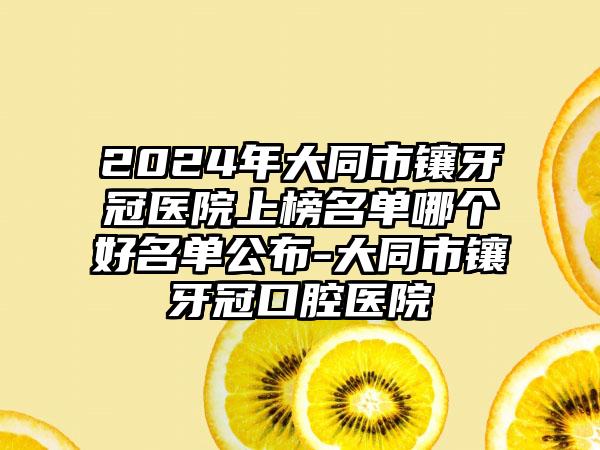 2024年大同市镶牙冠医院上榜名单哪个好名单公布-大同市镶牙冠口腔医院