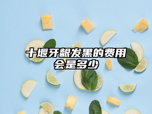 十堰牙龈发黑的费用会是多少