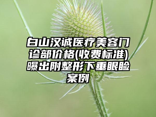 白山汉诚医疗美容门诊部价格(收费标准)曝出附整形下垂眼睑案例