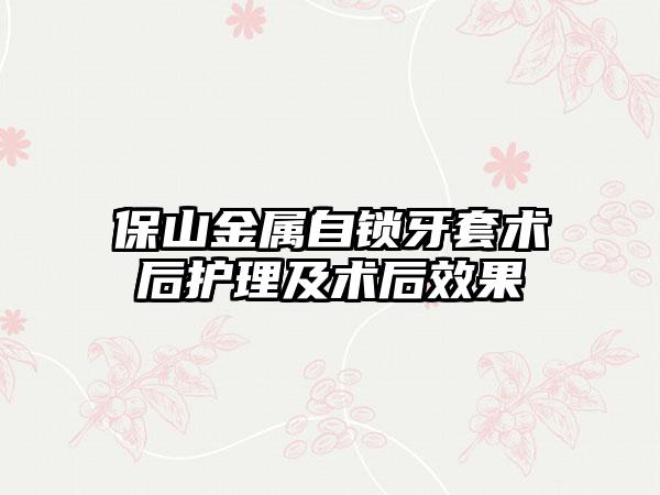 保山金属自锁牙套术后护理及术后效果