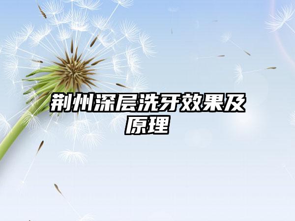 荆州深层洗牙效果及原理