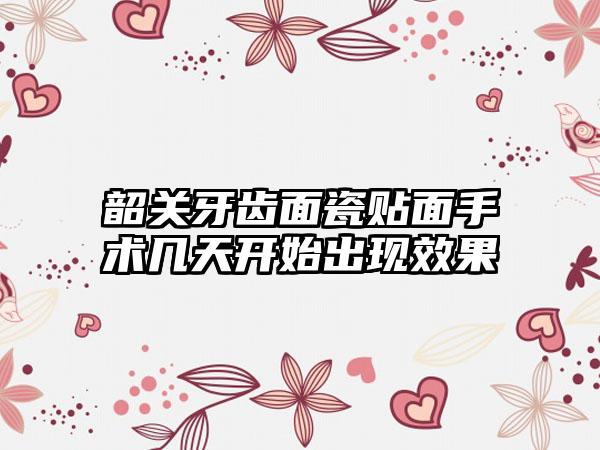 韶关牙齿面瓷贴面手术几天开始出现效果